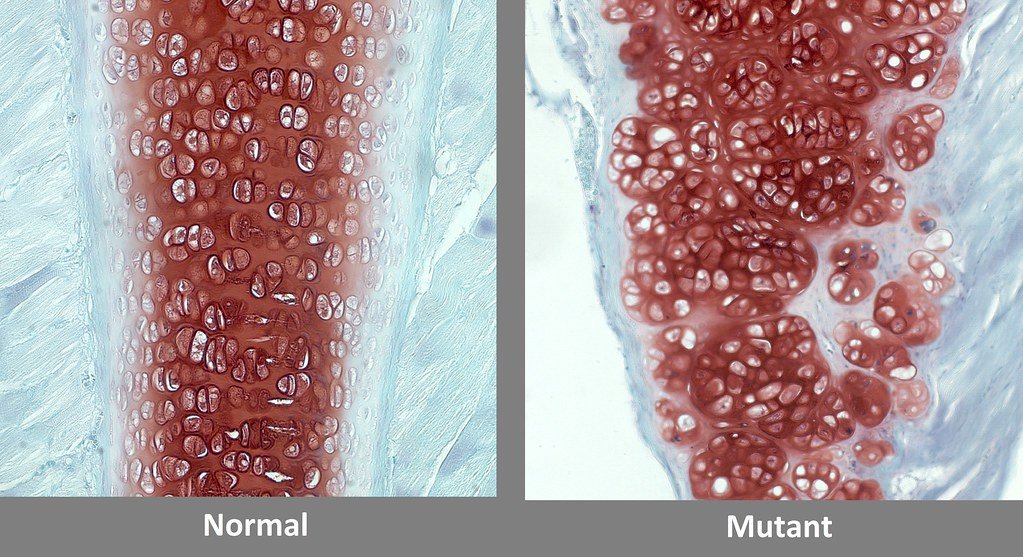14 Rare Diseases You Should Know - General Knowledge - News